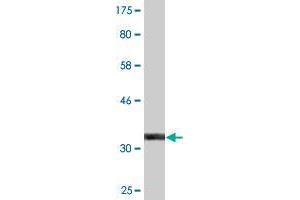 Western Blot detection against Immunogen (32.