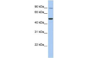 WB Suggested Anti-TRPV5  Antibody Titration: 0.