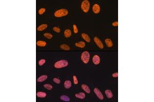 Immunofluorescence analysis of U-2 OS cells using KHDRBS1/KHDRBS1/Sam68 Rabbit mAb (ABIN1680037, ABIN3018237, ABIN3018238 and ABIN7101585) at dilution of 1:100 (40x lens).