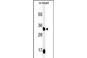 Western blot analysis of COQ9 Antibody in mouse heart tissue lysates (35ug/lane) (COQ9 anticorps  (AA 156-184))