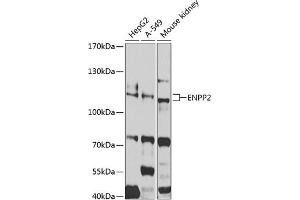 Western blot analysis of extracts of various cell lines, using ENPP2 antibody (ABIN3023333, ABIN3023334, ABIN3023335 and ABIN6219607) at 1:1000 dilution. (ENPP2 anticorps  (AA 564-863))