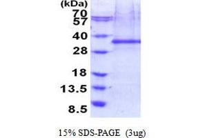 SDS-PAGE (SDS) image for Four and A Half LIM Domains 2 (FHL2) (AA 1-279) protein (His tag) (ABIN5853936)