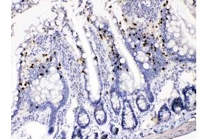 AKR1B1 was detected in paraffin-embedded sections of rat intestine tissues using rabbit anti- AKR1B1 Antigen Affinity purified polyclonal antibody (Catalog # ) at 1 µg/mL.