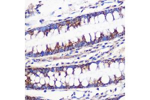 Immunohistochemistry of paraffin-embedded Human colon using MRPL54 Rabbit pAb (ABIN7268578) at dilution of 1:100 (40x lens). (MRPL54 anticorps  (AA 1-138))