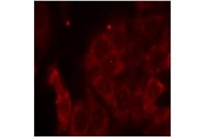 Image no. 3 for anti-Protein-tyrosine Phosphatase 1C (PTPN6) (Tyr536) antibody (ABIN197592)