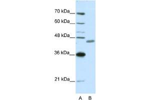WB Suggested Anti-ZNF396 Antibody Titration:  0. (ZNF396 anticorps  (N-Term))
