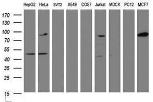 Image no. 2 for anti-ATR Interacting Protein (ATRIP) (AA 42-309) antibody (ABIN1491509) (ATRIP anticorps  (AA 42-309))