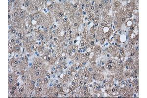 Immunohistochemical staining of paraffin-embedded Human prostate tissue using anti-PIM2 mouse monoclonal antibody. (PIM2 anticorps)