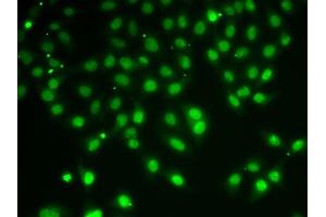Immunofluorescence analysis of A-549 cells using HD antibody (ABIN6133742, ABIN6141675, ABIN6141678 and ABIN6213911).