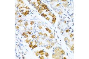 Immunohistochemistry of paraffin-embedded human stomach using BMP3 antibody.