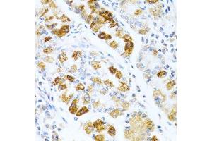 Immunohistochemistry of paraffin-embedded human stomach using BMP3 antibody. (BMP3 anticorps  (AA 243-472))