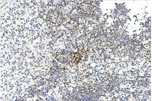 Immunohistochemical analysis of paraffin-embedded human spleen section using GREMLIN Antibody (C-term) (ABIN390078 and ABIN2840598).