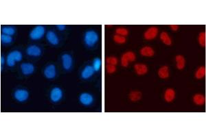 Immunofluorescence analysis of 293T cells using DiMethyl-Histone H3-K4 Polyclonal Antibody (Histone 3 anticorps  (2meLys4))