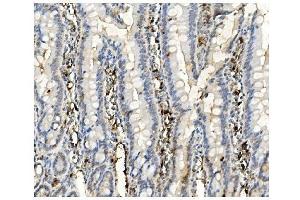 IHC analysis of BubR1/BUB1B using anti-BubR1/BUB1B antibody (ABIN7600961). (BUB1B anticorps  (AA 26-448))