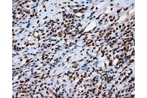 Immunohistochemical staining of paraffin-embedded Kidney tissue using anti-KIAA1609 mouse monoclonal antibody. (KIAA1609 anticorps)