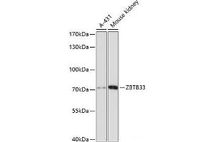 Western blot analysis of extracts of various cell lines using ZBTB33 Polyclonal Antibody at dilution of 1:3000. (ZBTB33 anticorps)