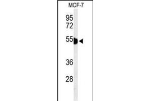 Western blot analysis of KRT1 Antibody (Center) (ABIN653648 and ABIN2842989) in MCF-7 cell line lysates (35 μg/lane).