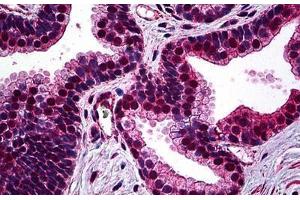 Human Prostate: Formalin-Fixed, Paraffin-Embedded (FFPE) (SMC1A anticorps  (AA 366-466))