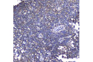 IHC analysis of Synaptotagmin 1 using anti-Synaptotagmin 1 antibody .