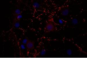 Indirect immunostaining of PFA fixed rat hippocampus neurons (dilution 1 : 500; red).