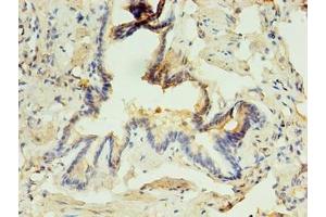 Immunohistochemistry of paraffin-embedded human lung tissue using ABIN7163325 at dilution of 1:100 (ABHD3 anticorps  (AA 52-309))