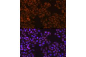 Immunofluorescence analysis of HeLa cells using FSP1/S100 Rabbit mAb (ABIN7270125) at dilution of 1:100 (40x lens). (s100a4 anticorps)