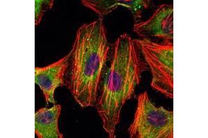 Immunofluorescence analysis of Hela cells using STAT3 antibody (green).