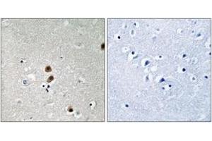 Immunohistochemistry analysis of paraffin-embedded human brain, using CtBP1 (Phospho-Ser422) Antibody.
