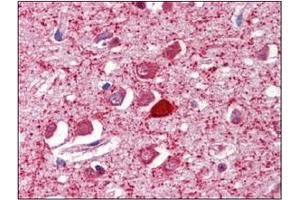 Image no. 1 for anti-Parvalbumin (PVALB) (C-Term) antibody (ABIN374572) (PVALB anticorps  (C-Term))