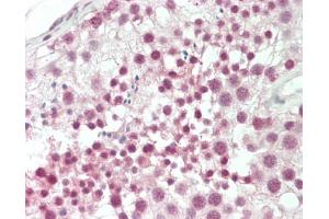 Human Testis: Formalin-Fixed, Paraffin-Embedded (FFPE).