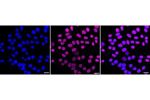 anti-GTP Binding Protein 4 (GTPBP4) antibody