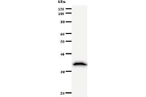Western Blotting (WB) image for anti-MGA antibody (ABIN930939) (MGA anticorps)