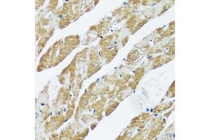 Immunohistochemistry of paraffin-embedded mouse heart using C antibody (ABIN7266047) at dilution of 1:100 (40x lens). (CASQ2 anticorps  (AA 20-399))