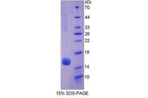 SDS-PAGE of Protein Standard from the Kit (Highly purified E. (HEXB Kit ELISA)