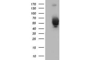 Western Blotting (WB) image for anti-Bestrophin 3 (BEST3) antibody (ABIN1501729) (Bestrophin 3 anticorps)