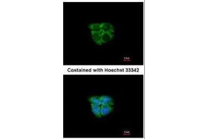 ICC/IF Image Immunofluorescence analysis of paraformaldehyde-fixed A431, using Adenosine kinase, antibody at 1:200 dilution.