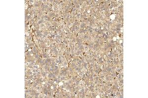 IHC analysis of SNX4 using anti-SNX4 antibody (ABIN7599406).