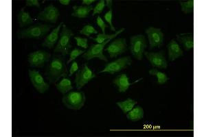 Immunofluorescence of monoclonal antibody to RUNX1 on HeLa cell. (RUNX1 anticorps  (AA 210-310))