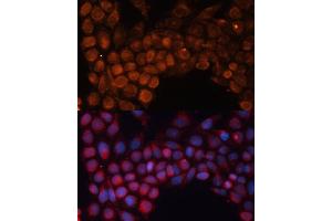 Immunofluorescence analysis of HeLa cells using SLC25 antibody (ABIN6132661, ABIN6147921, ABIN6147922 and ABIN6215721) at dilution of 1:100.