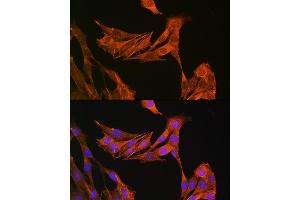 Immunofluorescence analysis of NIH-3T3 cells using PALLD Rabbit pAb  at dilution of 1:100 (40x lens).