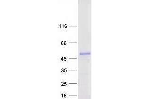 Validation with Western Blot