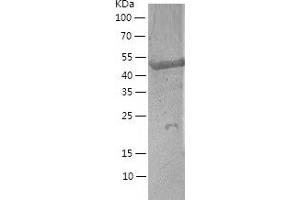 Western Blotting (WB) image for Angiopoietin-Like 2 (ANGPTL2) (AA 23-493) protein (His-IF2DI Tag) (ABIN7121831)