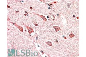 ABIN870635 (5µg/ml) staining of paraffin embedded Human Cerebral Cortex. (Myosin IB anticorps  (Internal Region))