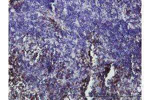 Immunoperoxidase of monoclonal antibody to GFI1 on formalin-fixed paraffin-embedded human lymph node.