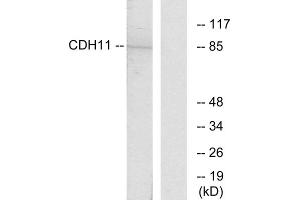 Western blot analysis of extracts from Jurkat cells, using CDH11 antibody. (OB Cadherin anticorps  (Internal Region))