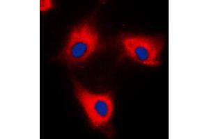 Immunofluorescent analysis of 14-3-3 theta/tau staining in HeLa cells. (14-3-3 theta anticorps  (C-Term))
