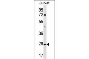 OR6T1 Antibody (C-term) (ABIN656305 and ABIN2845608) western blot analysis in Jurkat cell line lysates (35 μg/lane).