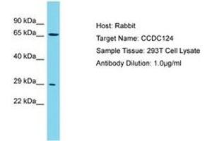 Image no. 1 for anti-Coiled-Coil Domain Containing 124 (CCDC124) (AA 46-95) antibody (ABIN6750742) (CCDC124 anticorps  (AA 46-95))