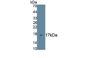 Detection of Recombinant MUC1, Human using Monoclonal Antibody to Mucin 1 (MUC1)