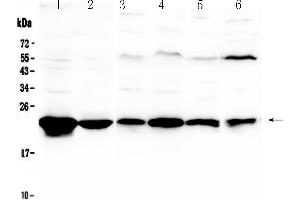 Western blot analysis of GST3 / GST pi using anti-GST3 / GST pi antibody . (GSTP1 anticorps  (AA 2-210))